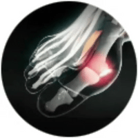 Reduce el dolor rápidamente