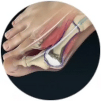 Realinea el dedo progresivamente